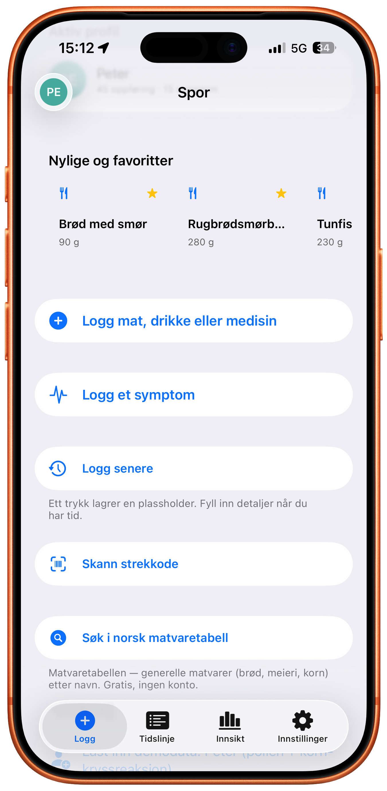 ConsumptionLogView med favoritter, strekkode-scanning og Matvaretabell-søk